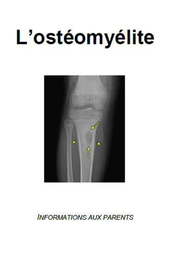 Splenectomie vaccination