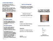 Le test cutané Tuberculinique (TCT)